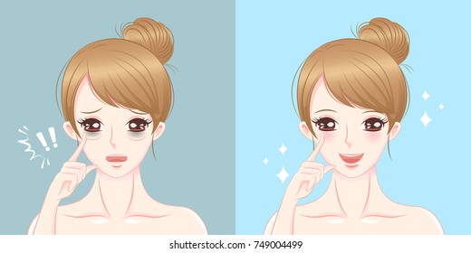 Woman Eye Bags Before And After On The Blue Background