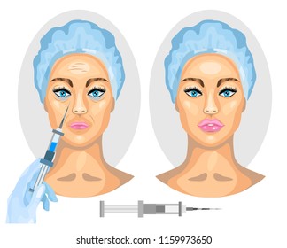 Woman face Before and after Cosmetic surgery. Facial wrinkle treatment injection. Vector