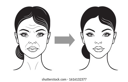 Woman face before and after facelift,  anti-aging. Vector illustration on a white background.  
