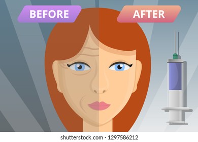 Woman face before after lifting concept banner. Cartoon illustration of woman face before after lifting vector concept banner for web design