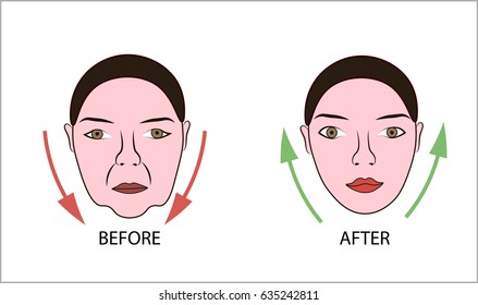 Woman face before and after face lifting