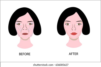 Woman Face Before After Face Lifting Stock Vector (royalty Free 