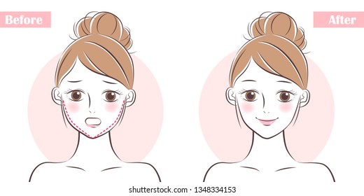 woman face before and after plastic surgery 