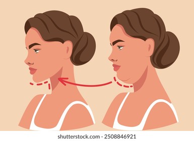 Woman face before and after weight loss. Double chin. Vector illustration for advertising, website, banner, posters