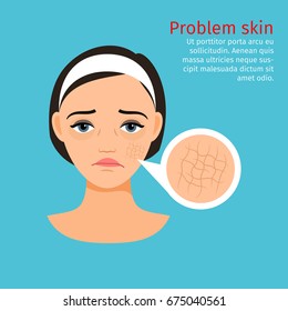 Woman face with dry skin problem, vector illustration