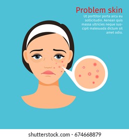 Woman face problem skin with acne, vector illustration