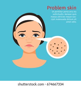 Woman face problem skin with black dots, vector illustration