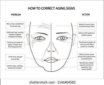 Woman face scheme demonstrating causes of facial wrinkles and folds and ways of correction aging signs