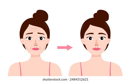 Woman face wrinkles before and after skin care treatment in flat design. Anti-aging therapy.