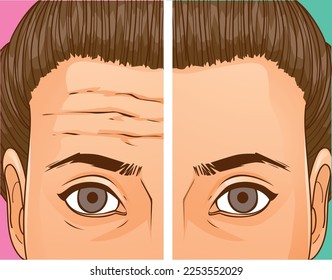 The woman faced age problems. Age skin. Wrinkles on the forehead. Before, after. healthcare illustration. Vector illustration.