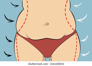 Woman fat belly with dotted line. Vector illustration. Weight and health problem concept.