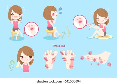 Woman Feel Pain With Tinea Pedis On Blue Background