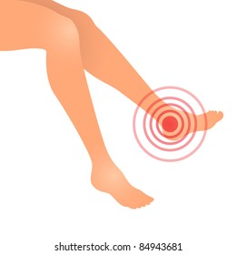 Woman feet swollen or feet pain, vector illustration