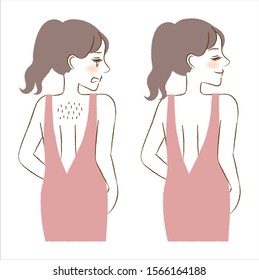 Woman with hair on her back