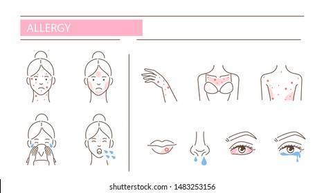 Woman has allergy diseases symptoms - skin rash, cough, snot, conjunctivitis. Set of  icons about dermatitis illness signs. Flat line vector illustration isolated on white background.
