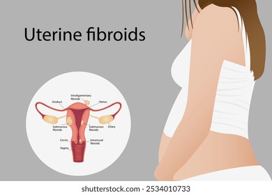 A woman has a stomach ache. Ovarian and cervical cancer, cervical disorder, endometriosis, hysterectomy, uterine fibroids, reproductive system, menstruation