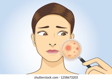 Woman holding magnifying glass for looking acne on her facial. Illustration about skin problem.