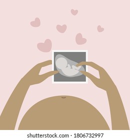 A woman is holding an ultrasound picture of her child in her hands. Vector illustration of a pregnant woman, pregnant belly. Mom's love for a baby