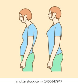 Woman with impaired posture position defect scoliosis and ideal bearing.