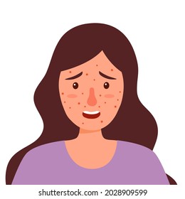 Mujer con la cara picante en diseño plano sobre fondo blanco. Piel alérgica. Problema de la piel facial acné.