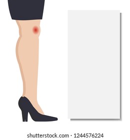 Woman with knee pain. Place for text. Vector illustration.