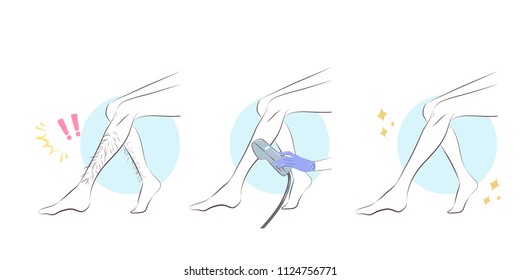 Woman Leg Hair Removal On The White Background