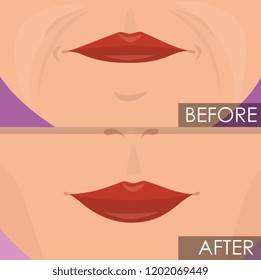 woman lips before and after treatment