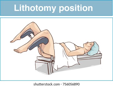 Lithotomy Position Images Stock Photos Vectors Shutterstock