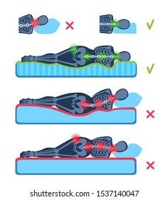 Una mujer tendida a su lado en el colchón. Silueta con esqueleto. Posiciones buenas y malas. Soporte para columna vertebral y cabeza. Dormir sano e insalubre, descansar, relajarse. Dibujo de dibujos animados comparativos