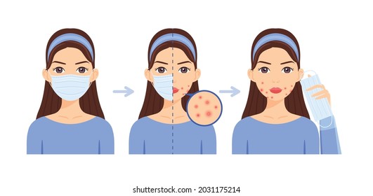 Woman With Medical Mask On Face. Protection Against Coronavirus. Girl Wears A Surgical Mask, Covering Mouth. Problems Skin. Pimples Acne. Female Character Holds A Mask In Hand. Cartoon Style. Vector