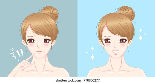 woman with mouth wrinkles problem on the blue background