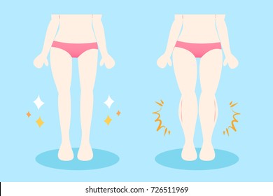 woman with muscular calves on the blue baclground
