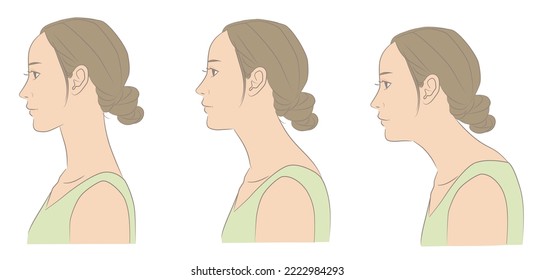 Woman with normal cervical spine and straight neck