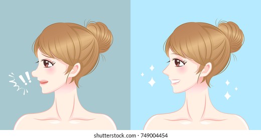 Woman Nose Before And After Cosmetic Surgery