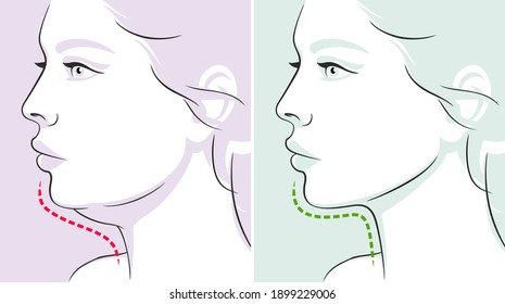 Woman profile, double chin, before-after. Woman face. Vector illustration