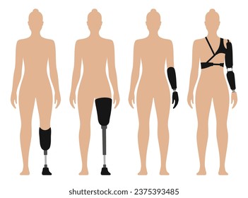 Woman with prosthetic arm and leg, medical vector illustration set, isolated on white background.