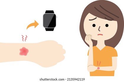 A woman with a rash on her wrist with a smartwatch