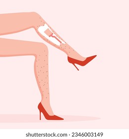 Woman removing hair from legs. Shaving with razor. Epilation advertisement poster. Female hairy legs in a high red heels. Vector illustration.