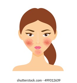 Woman with rosacea, psoriasis skin disease. Vector illustration of scab damaged female face