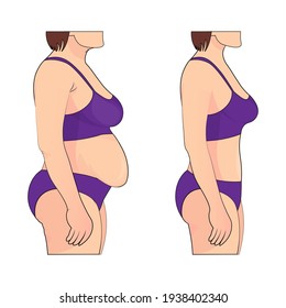 Fat and slim. Body shape Before and after reshaping vector illusstration  Stock Vector Image & Art - Alamy