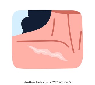 Woman with scar at chest concept. Cosmetic beauty treatments and surgeries. Correction of skin problems. Social media sticker. Cartoon flat vector illustration isolated on white background