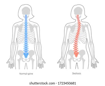 Lumbar Spine Anatomy Diagram High Res Stock Images Shutterstock