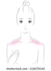 A woman with shoulder sunburn