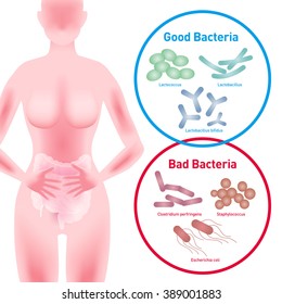 Woman silhouette and Good Bacteria and Bad Bacteria, enteric bacteria, Intestinal flora, Gut flora, probiotics, image illustration