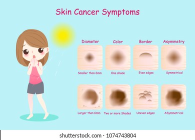 Woman With Skin Cancer Symptoms On The Blue Background