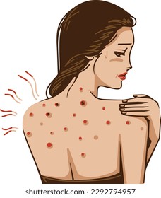 woman skin itchy because of acne dark and red spots on back