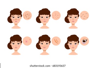 Woman with skin problem, acne. Vector illustration