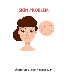 Woman with skin problem. Vector illustration