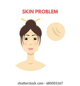 Woman with skin problem. Vector illustration