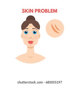 Woman with skin problem. Vector illustration